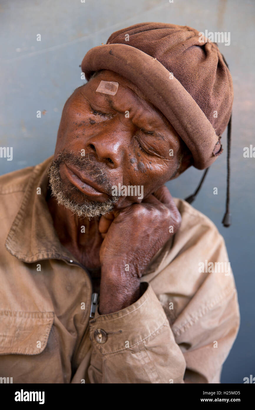 Ospedale Ribue, Nampula Provincia, Mozambico, Agosto 2015: Pacuneta Peteia, un fabbro da Mecuburi, attende la sua operazione di cataratta. Foto di Mike Goldwater Foto Stock