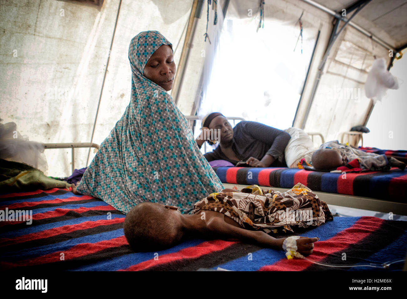 Malnutrion ward di Médecins sans frontières, Maiduguri, Stato di Borno, Nigeria Foto Stock