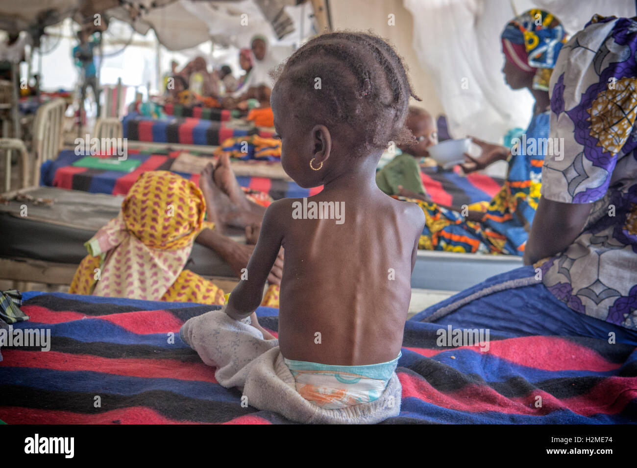 Malnutrion ward di Médecins sans frontières, Maiduguri, Stato di Borno, Nigeria Foto Stock