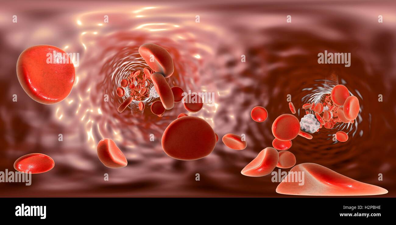 Le cellule rosse del sangue e di cellule bianche del sangue, illustrazione del computer. Panorama a 360 gradi all'interno del sangue di un vaso. Foto Stock