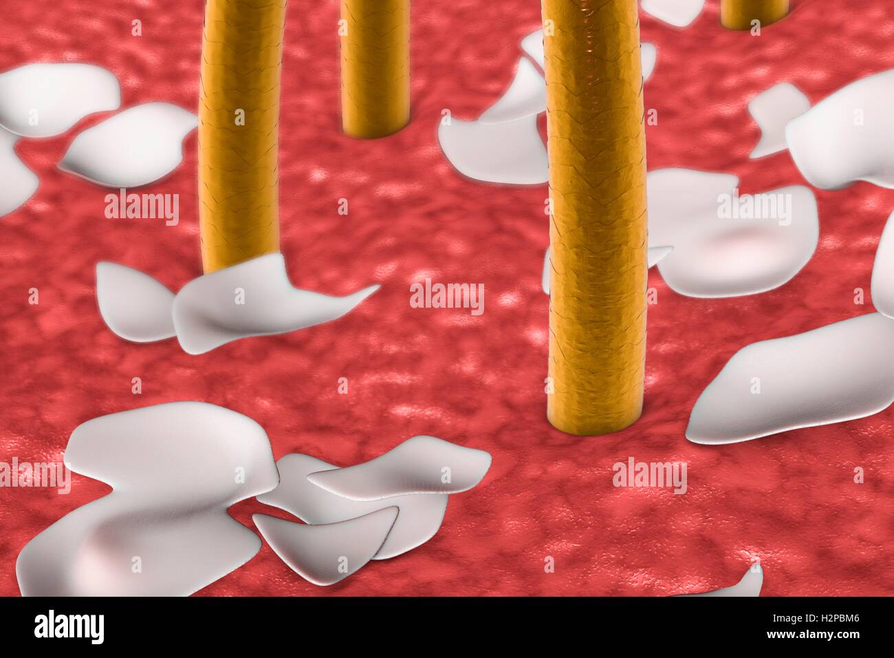 La pelle umana con forfora, illustrazione del computer. Foto Stock