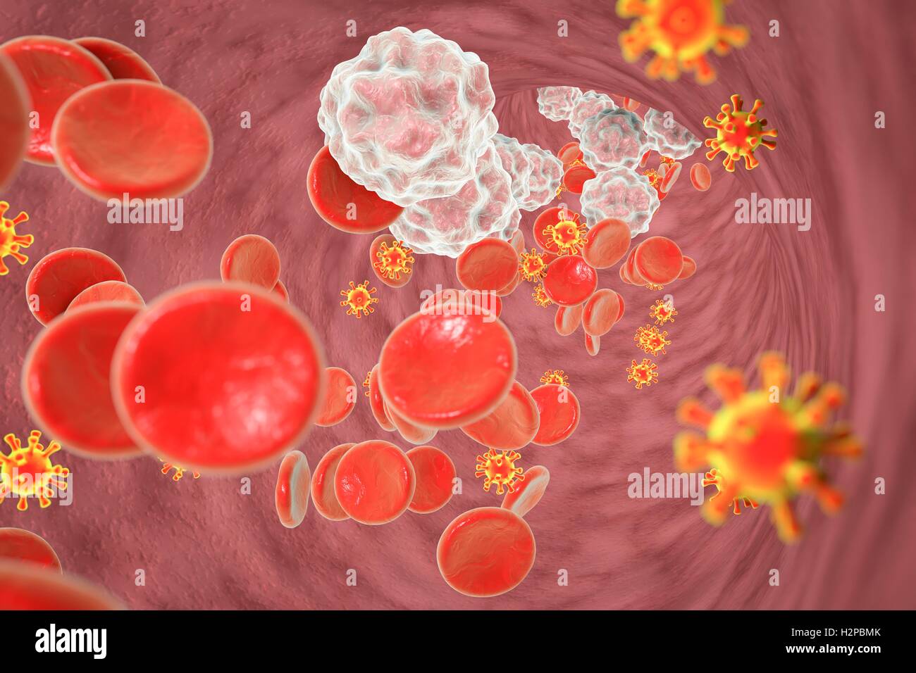 Illustrazione di Virus di Immunodeficienza Umana (HIV) nel sangue. L' HIV è un virus di RNA dalla famiglia Retroviridae che causa la sindrome da immunodeficienza acquisita (AIDS). Foto Stock