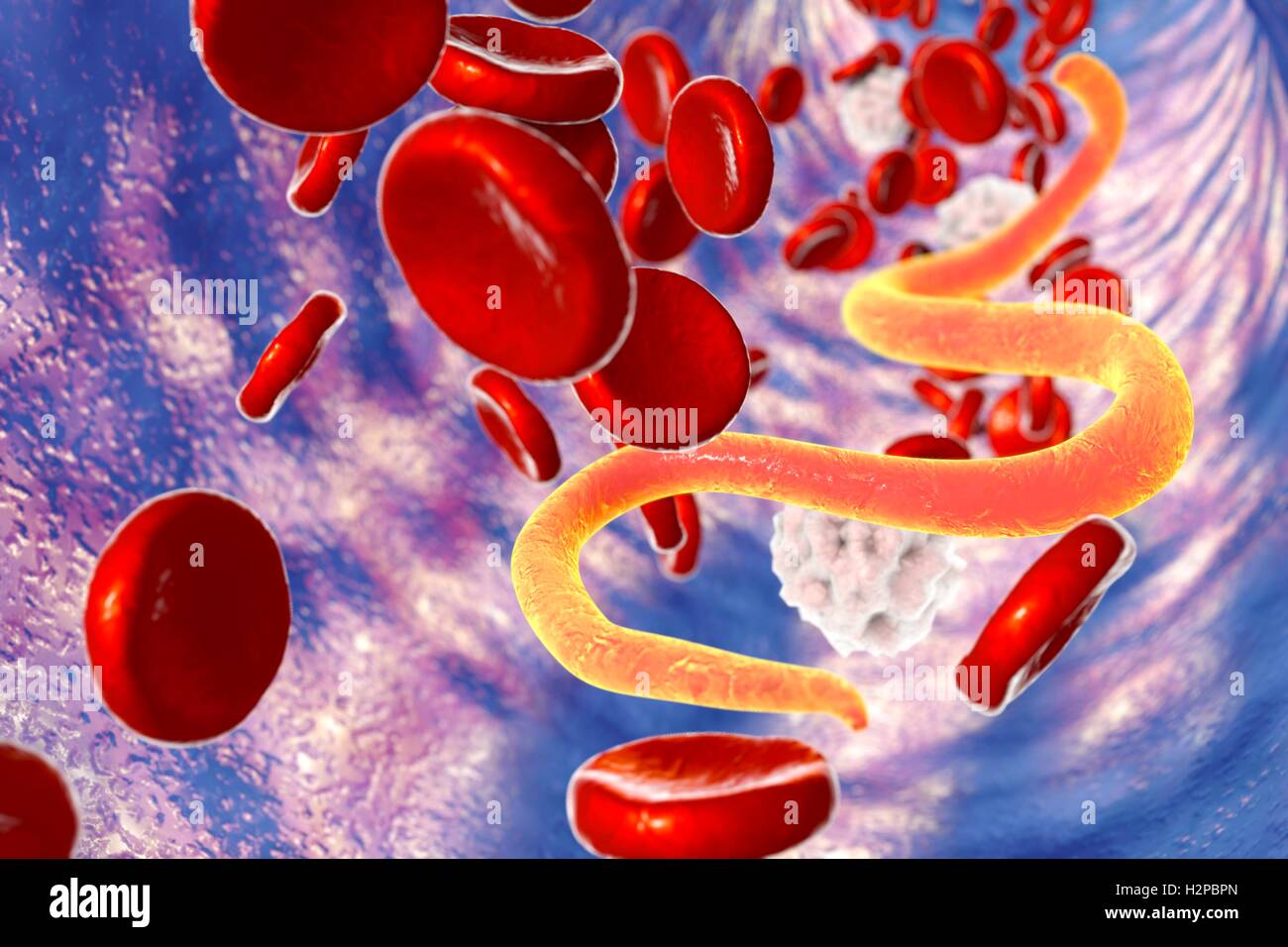Microfilaria worm nel sangue. Computer illustrazione che mostra immaturo filarial worm (microfilaria), la causa della filariosi. Le larve di worm si diffondono da persona a persona da succhiare sangue degli insetti e causare infiammazione dei vasi linfatici risultante in Foto Stock