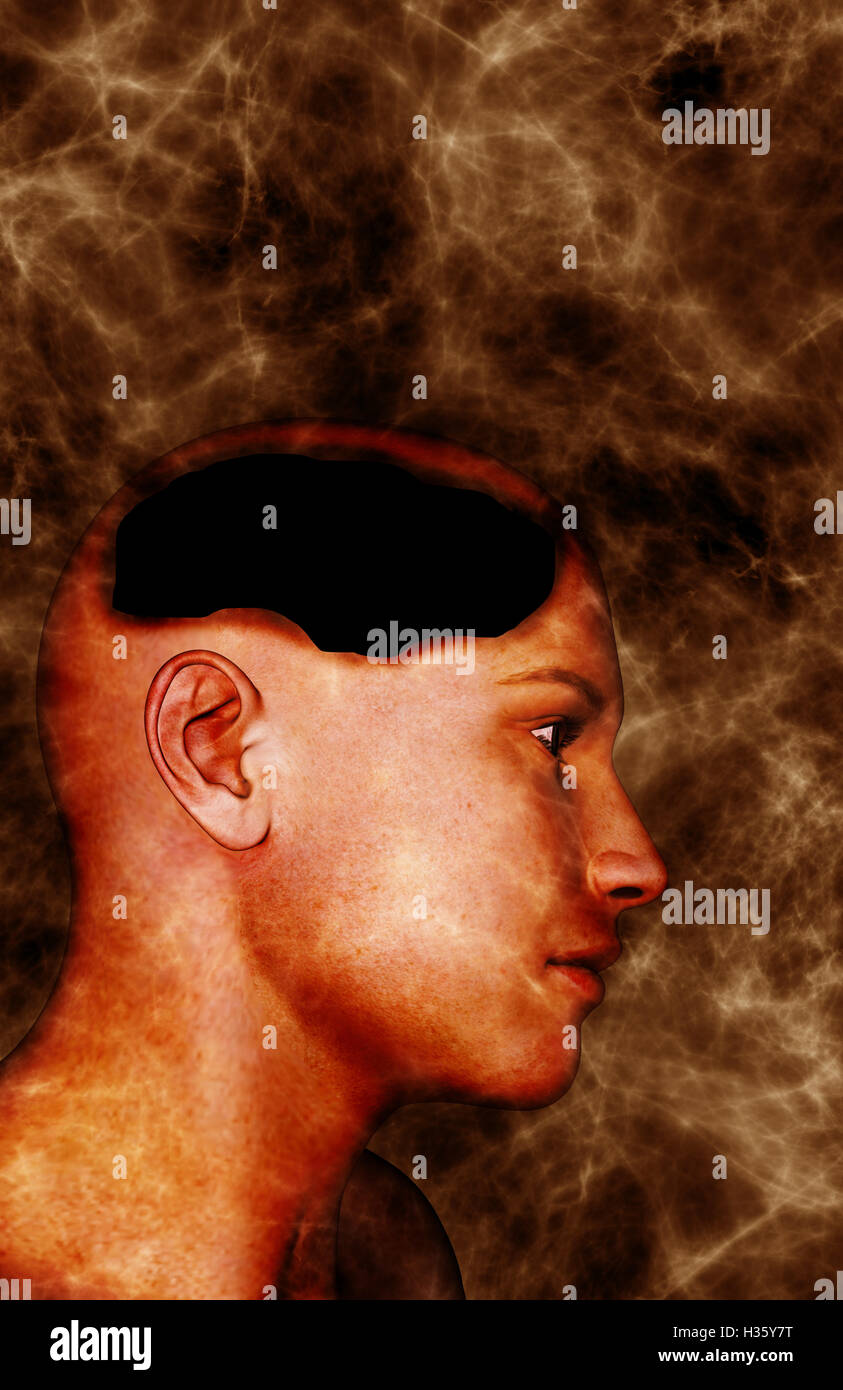 La perdita di memoria concetto Foto Stock