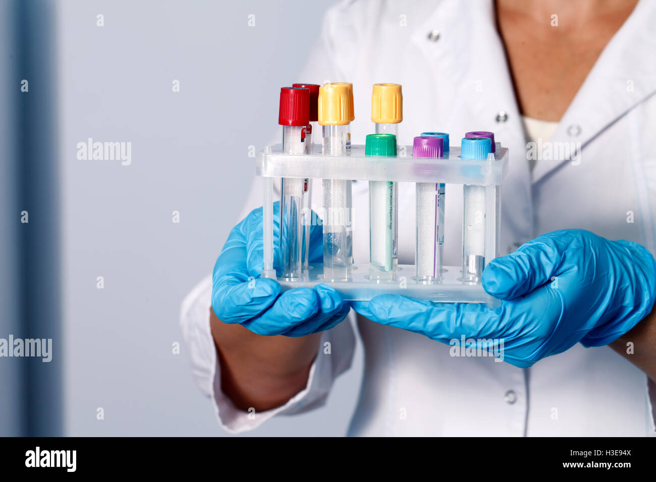 Una per i tubi di campionamento e di analisi, medico di fondo Foto Stock