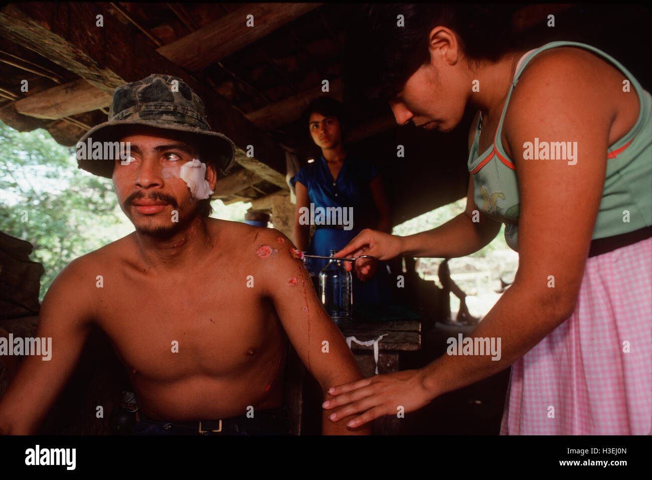 CHALATENANGO, EL SALVADOR, FEB 1984: - all'interno del FPL Guerrilla zone di controllo - un combattente di guerriglia ha le medicazioni cambiato sulle sue ferite in un ospedale da campo. Foto Stock