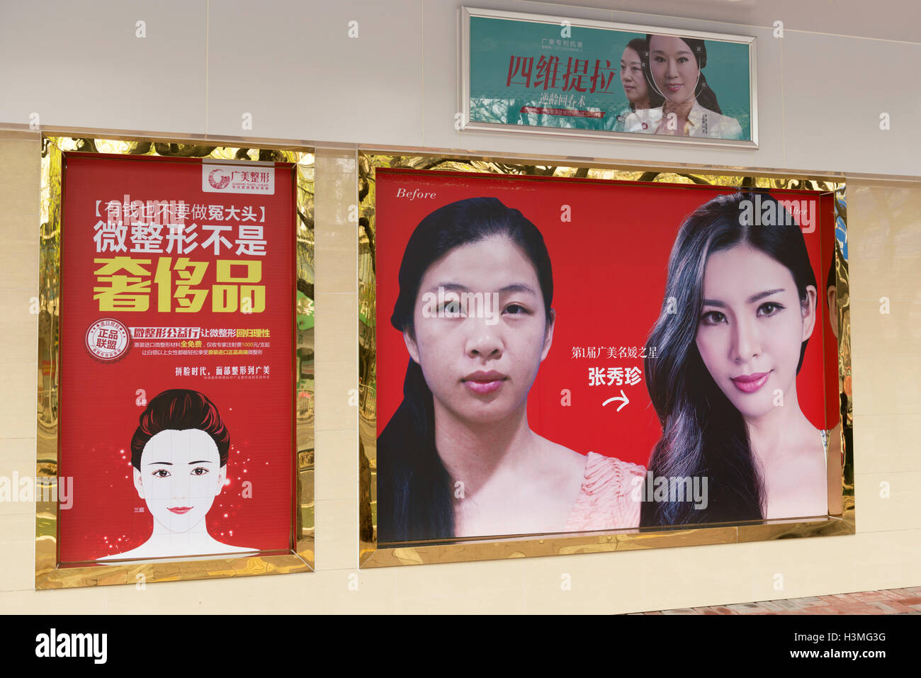 Chirurgia plastica pubblicità outdoor in Cina Foto Stock