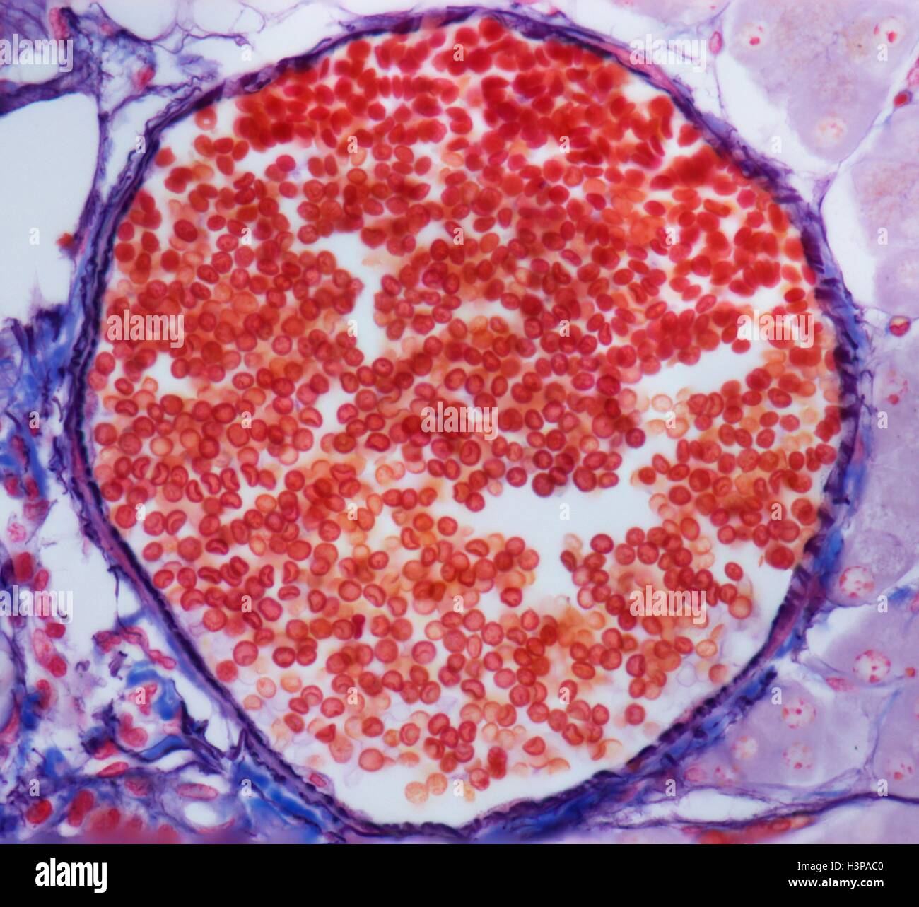Venula. Micrografia di luce (LM) di globuli rossi (eritrociti, rosso) in una venula. Questi vasi nascono da capillari e sono caratterizzati da un allargamento di diametro e l'acquisizione di fibroblasti e cellule mesenchimali (collettivamente i periciti) che si associano con l'aspetto esterno della venula parete. Ingrandimento: x300 quando stampata a 10 cm di larghezza. Foto Stock