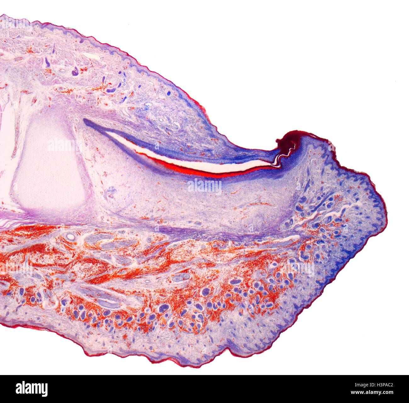 Il fingertip. Micrografia di luce (LM) di una sezione attraverso il fingertip. Il chiodo (arancione) è al centro superiore, con la radice delle unghie di seguito. Il letto ungueale è viola scuro ed è continuo con l'epitelio. La punta del dito di osso rosa pallido(centro sinistra). Al di sotto del epitelio squamoso stratificato è il derma, che contiene tessuto adiposo (FAT) cellule del tessuto connettivo e vasi sanguigni. Ingrandimento: x5 quando stampata a 10 cm di larghezza. Foto Stock