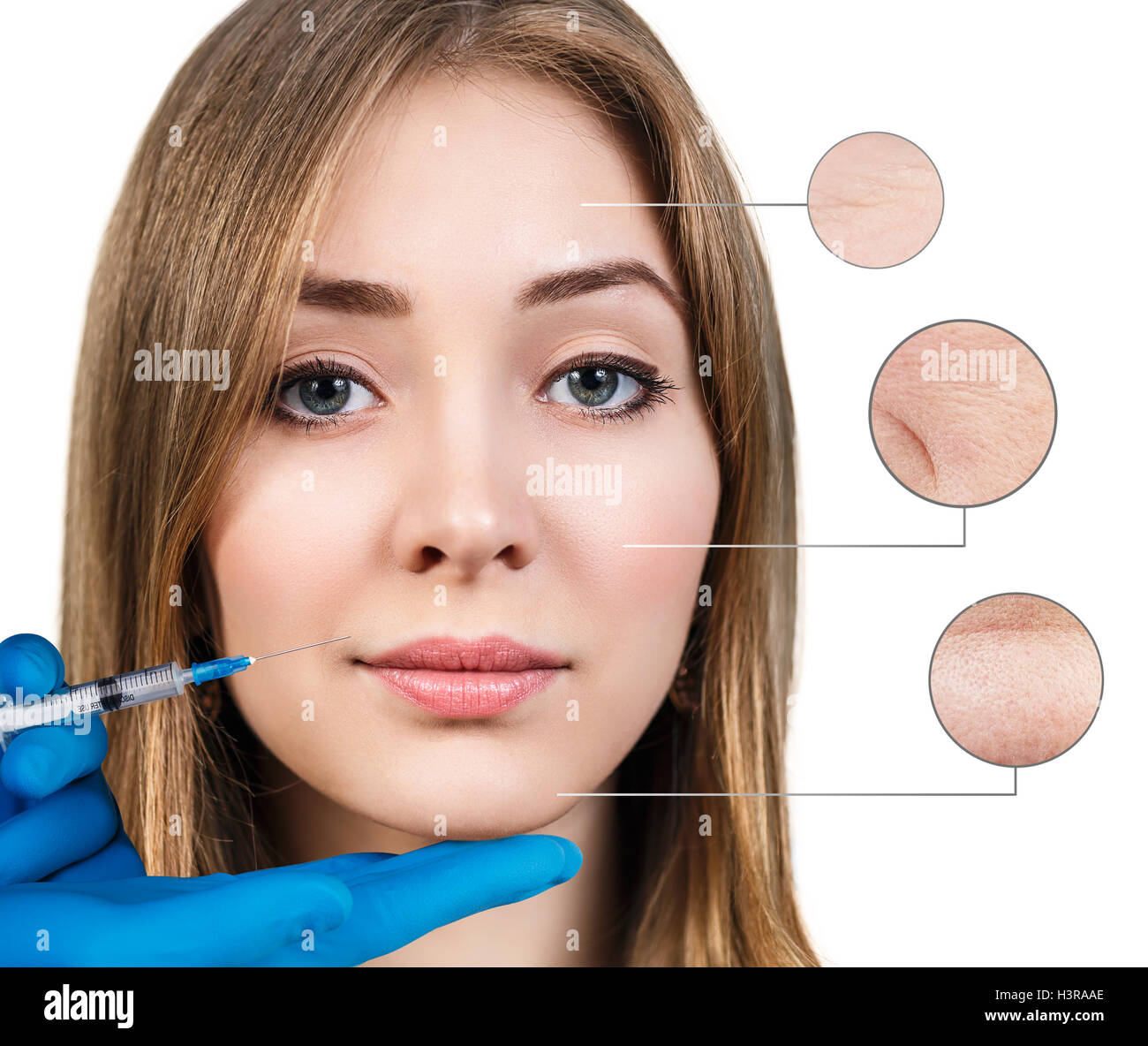 Iniezione di cosmetici per il bel volto femminile con cerchi di zoom. Isolato su sfondo bianco Foto Stock