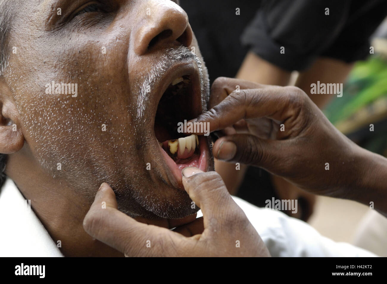 India, Uttar Pradesh, Varanasi, strada, dentista, paziente, trattamento, Foto Stock