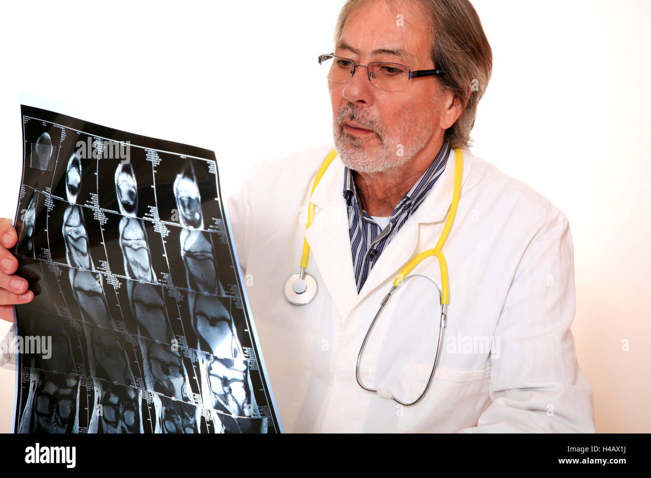 Medico, X-ray foto, del ginocchio, della diagnosi Foto Stock