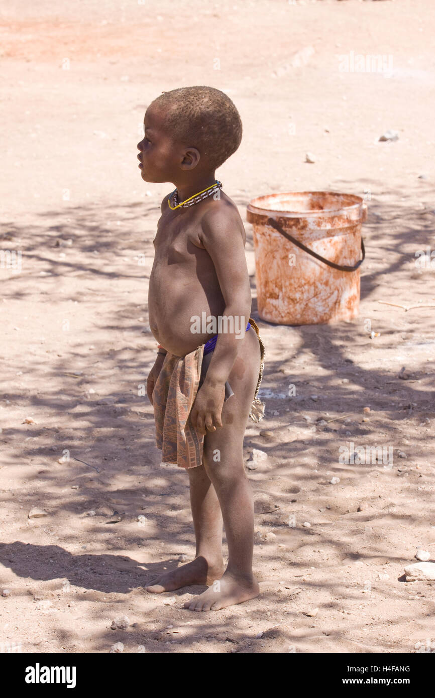 Himba bambino in un campo nel nord della Namibia, cattive condizioni di vita nel campo Foto Stock