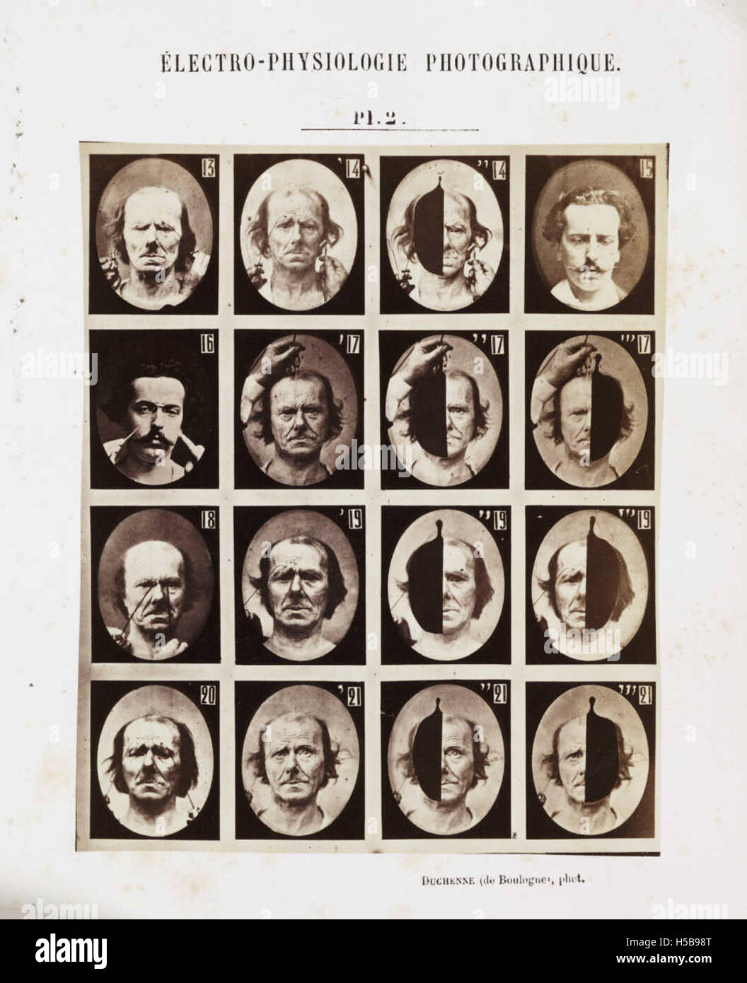 Pagina dell'opera "Mecanisme de la Physionomie Humaine", che mostra uno studio anatomico delle espressioni facciali umane. Foto Stock