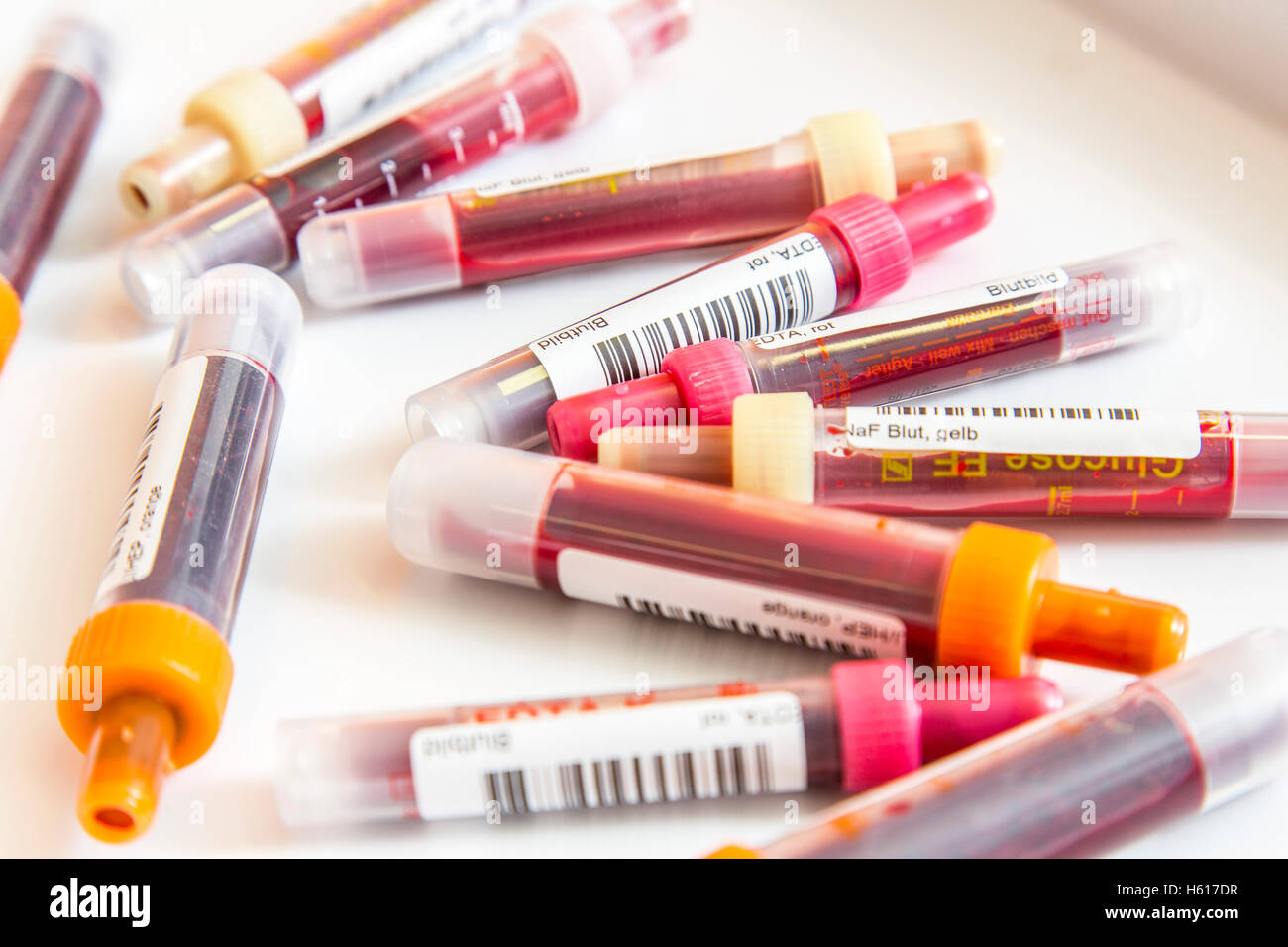 I campioni di sangue in provette per la raccolta di sangue, contenitore di campione per la raccolta e la preparazione dei campioni di sangue, codice a barre Foto Stock