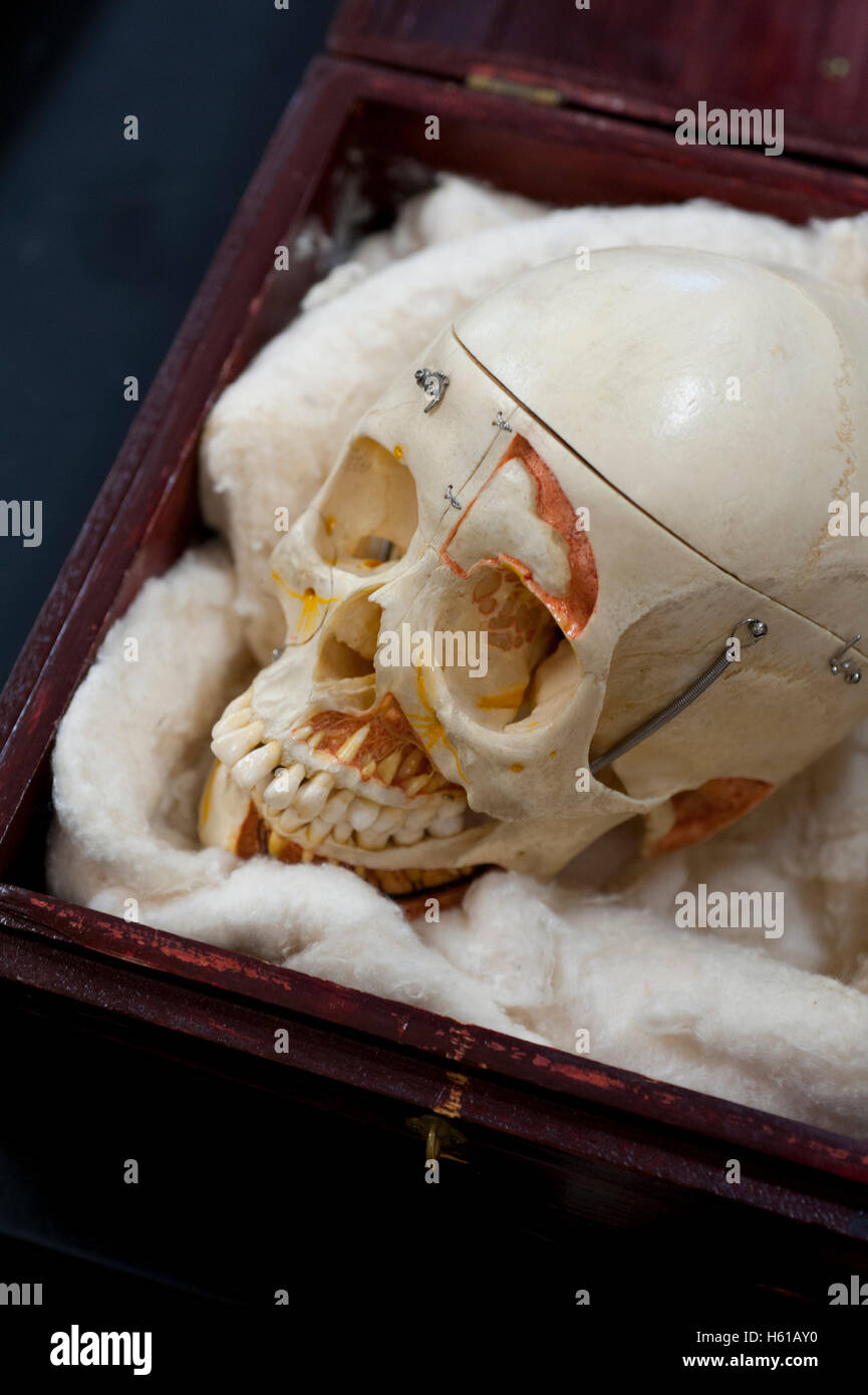Cranio umano capo donato all insegnamento di anatomia studi forensi scuola medica Salute Scienza Foto Stock