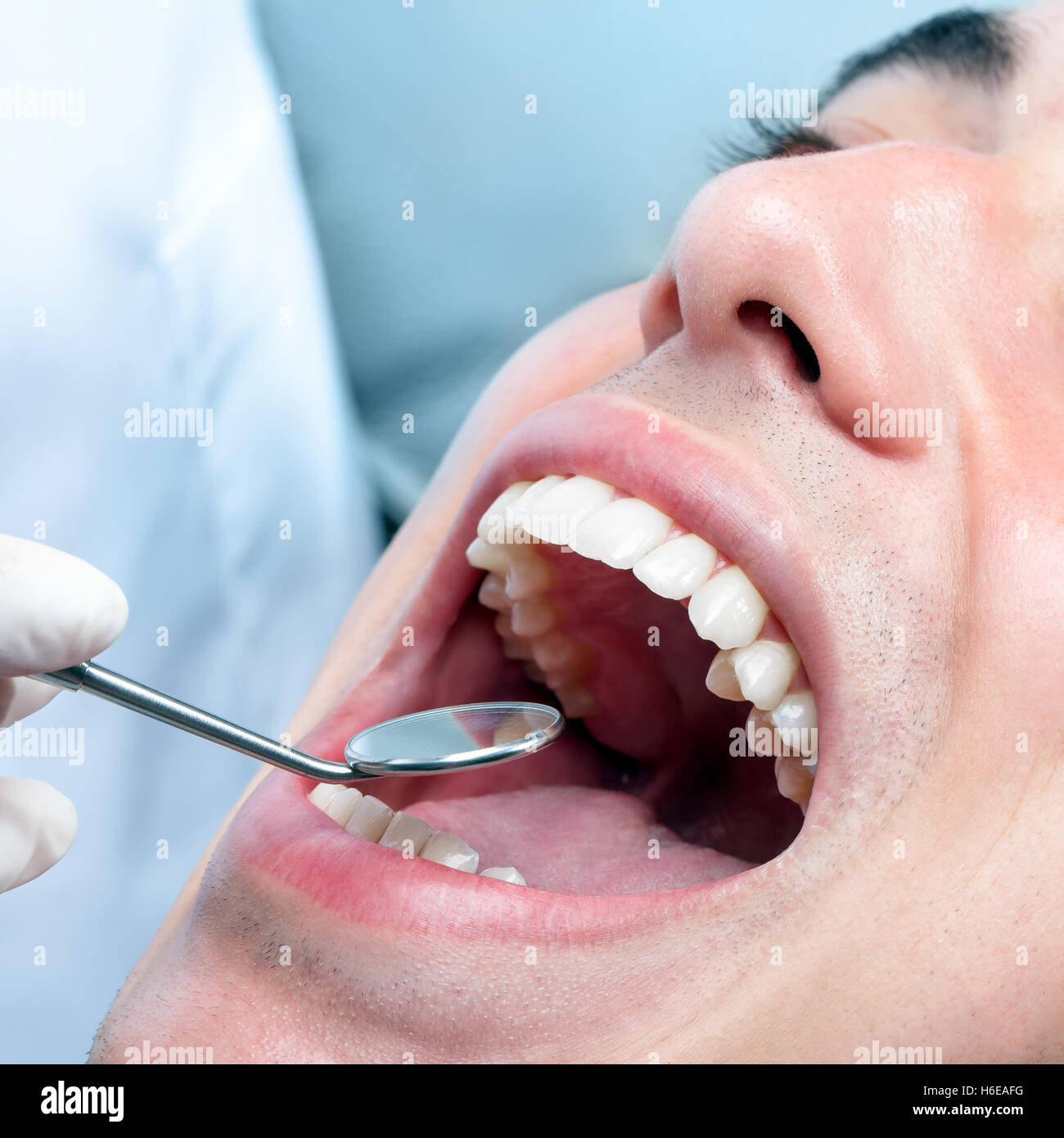 Macro close up del giovane uomo con la bocca aperta che mostra denti sani denti bianchi. Dentista mano controllo denti con specchio di bocca. Foto Stock