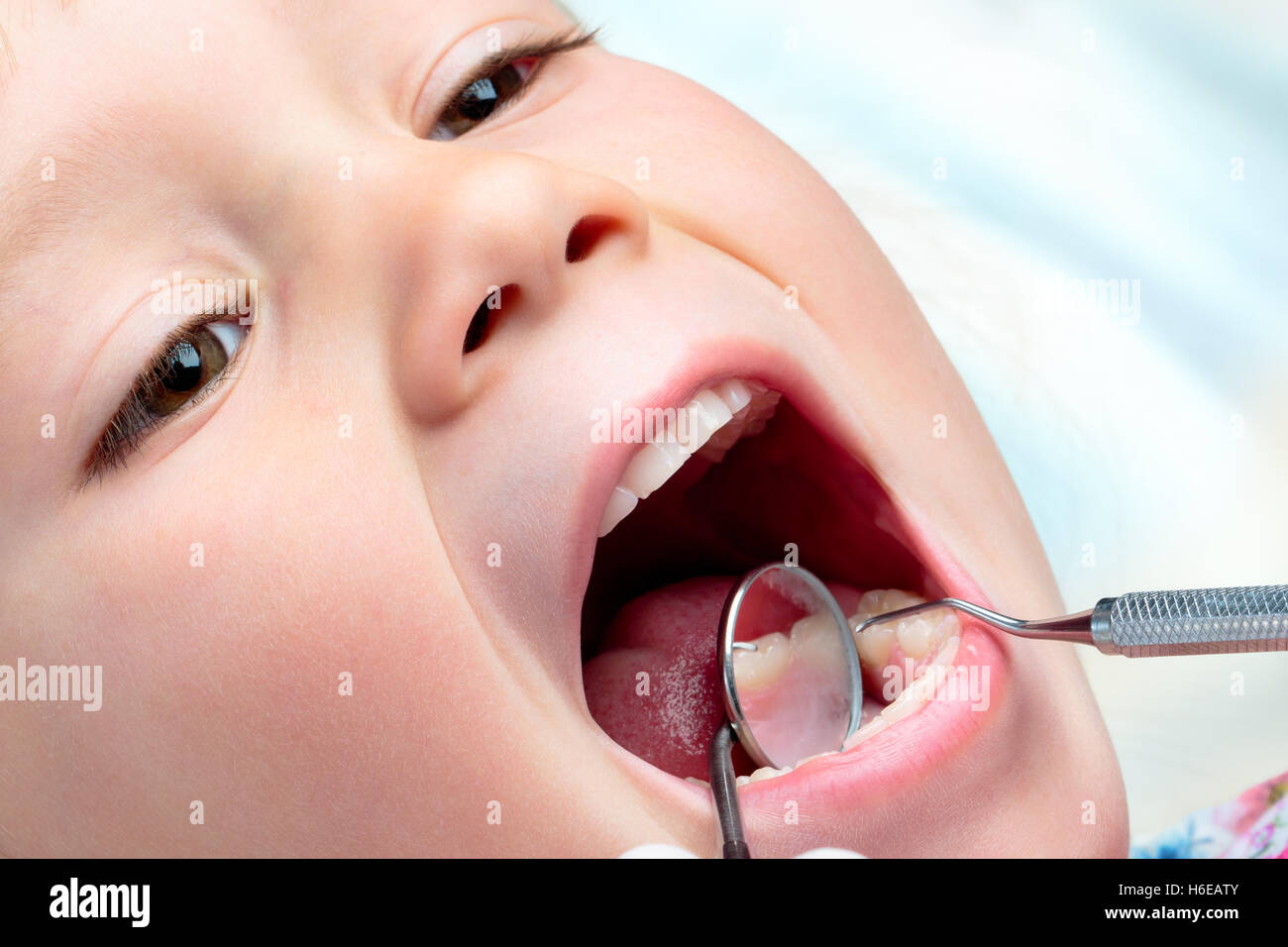 Extreme close up del neonato avente esame dentale. Ascia di guerra e la bocca specchio lavorando a bocca aperta. Foto Stock