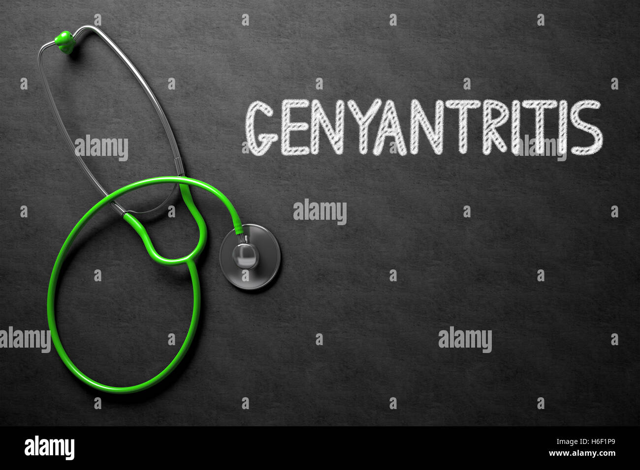 Genyantritis - Testo sulla lavagna. 3D'illustrazione. Foto Stock