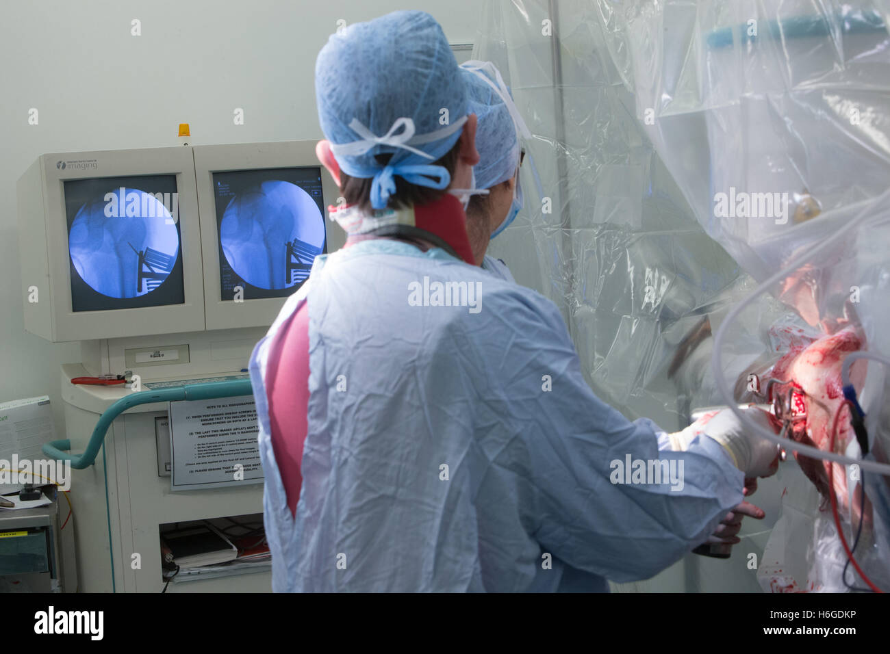 I chirurghi nel teatro lavorando su una decompressione di sinistra dell'anca il funzionamento della vite più comunemente noto come una sostituzione dell'anca Foto Stock