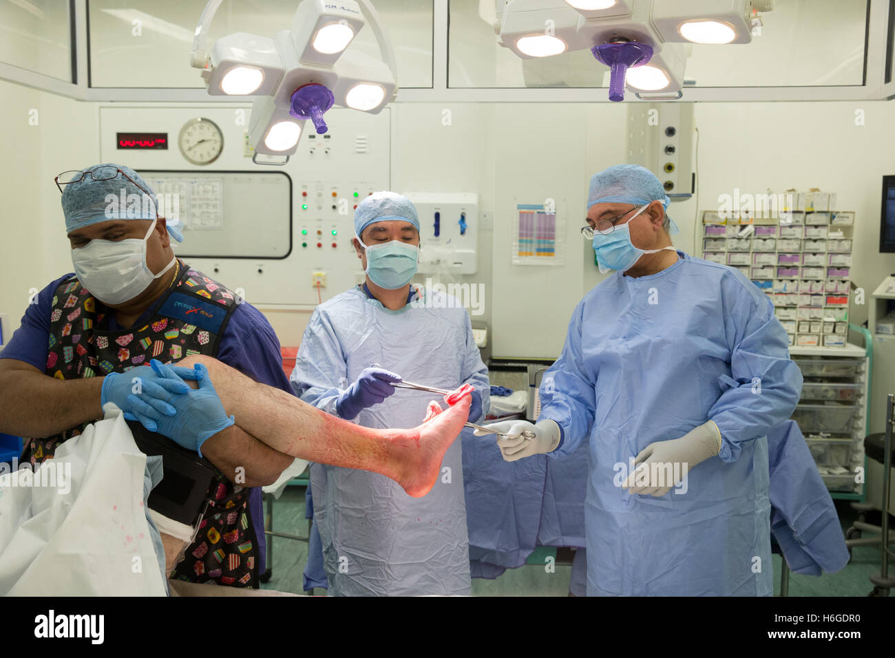 Un chirurgo e staff preparare il paziente per la chirurgia prima di effettuare una riduzione aperta e la fissazione interna di una caviglia sinistra Foto Stock