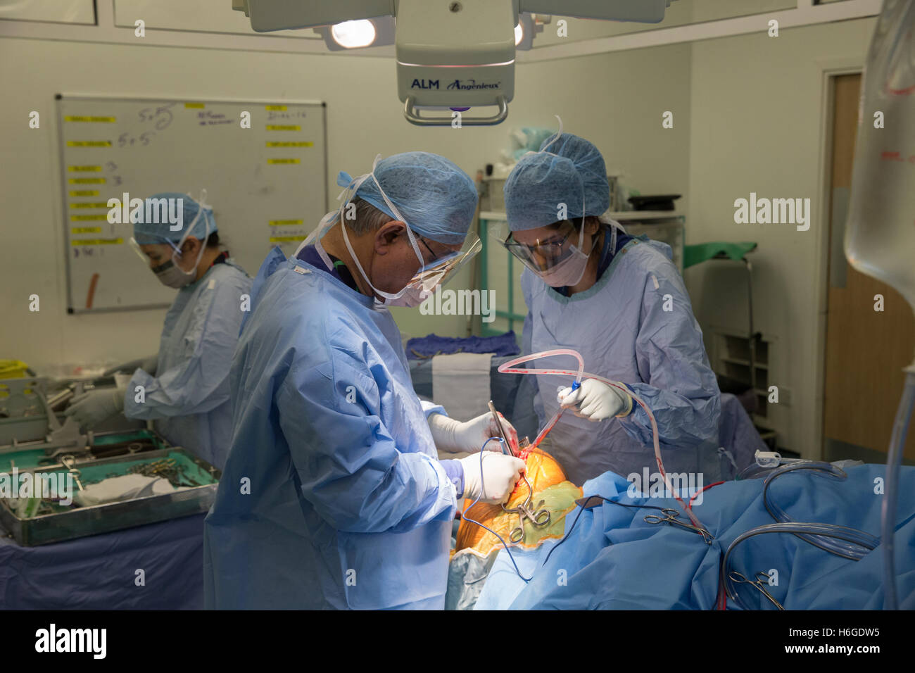Chirurgo ortopedico eseguendo una articolazione di ginocchio operazione di sostituzione in un teatro ospedaliero Foto Stock