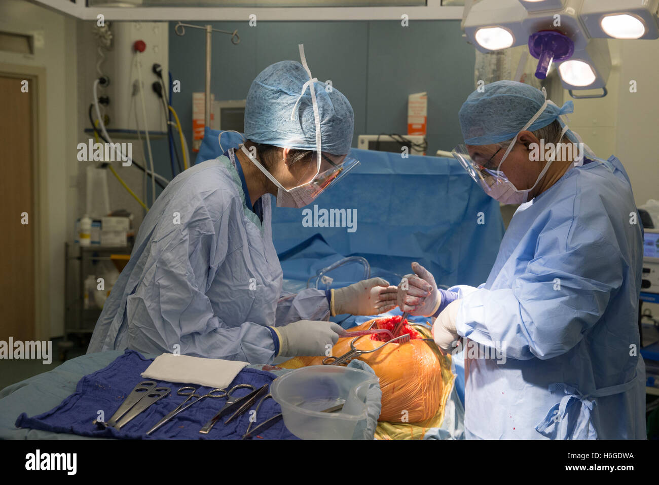 Chirurgo ortopedico eseguendo una articolazione di ginocchio operazione di sostituzione in un teatro ospedaliero Foto Stock