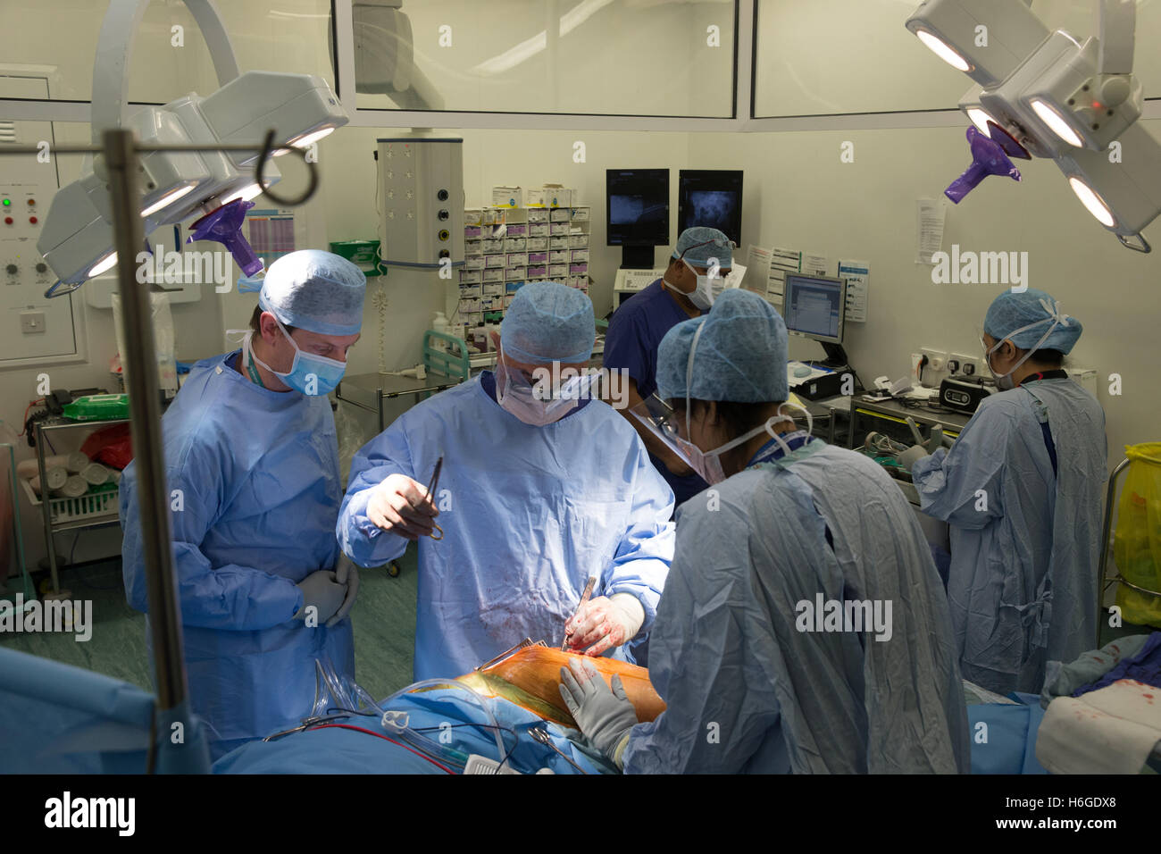 Operazione al ginocchio-la chirurgia di sostituzione del ginocchio Foto Stock