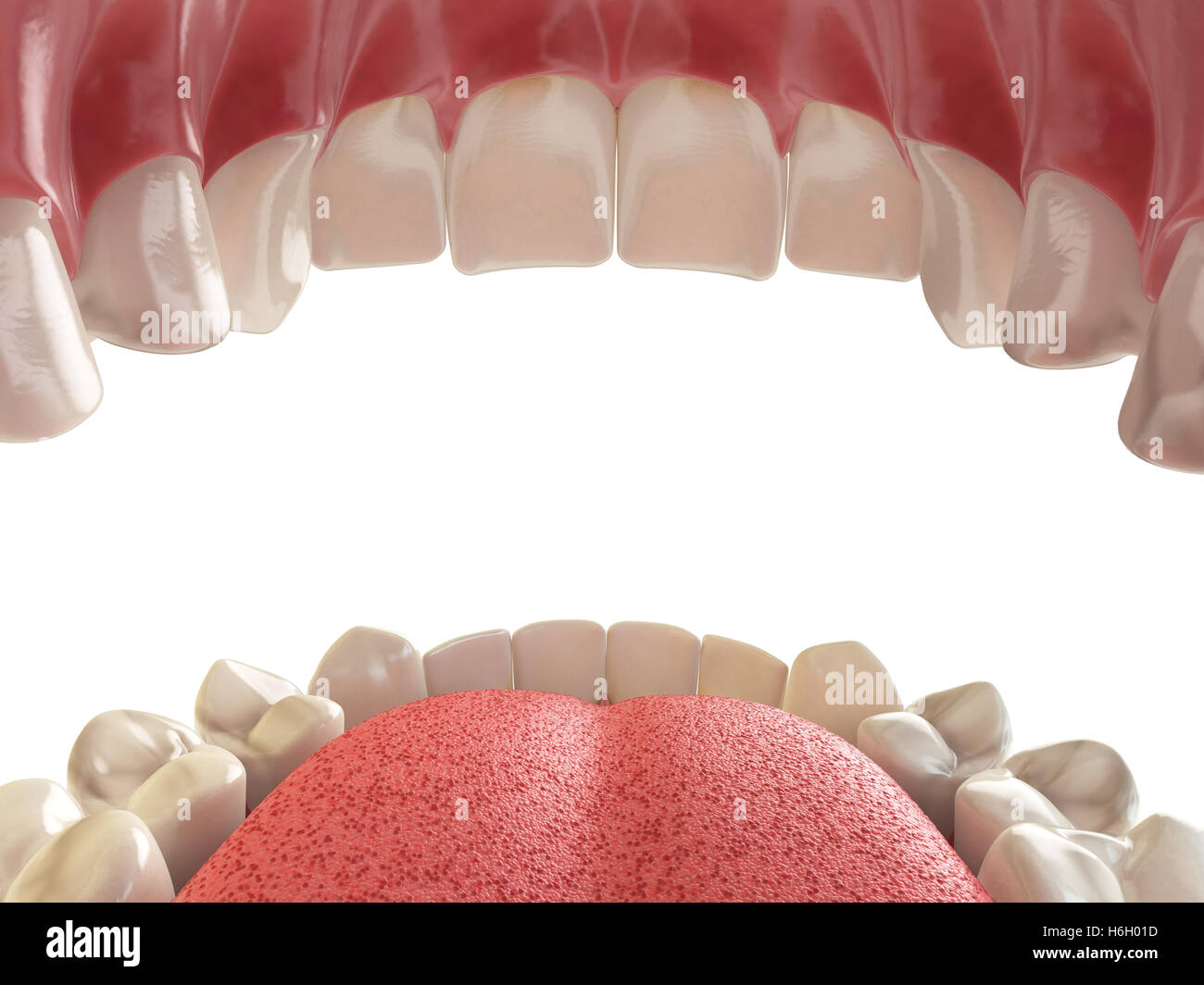 Denti o protesi. Aprire bocca umana mascellare superiore e inferiore. 3d illustrazione Foto Stock