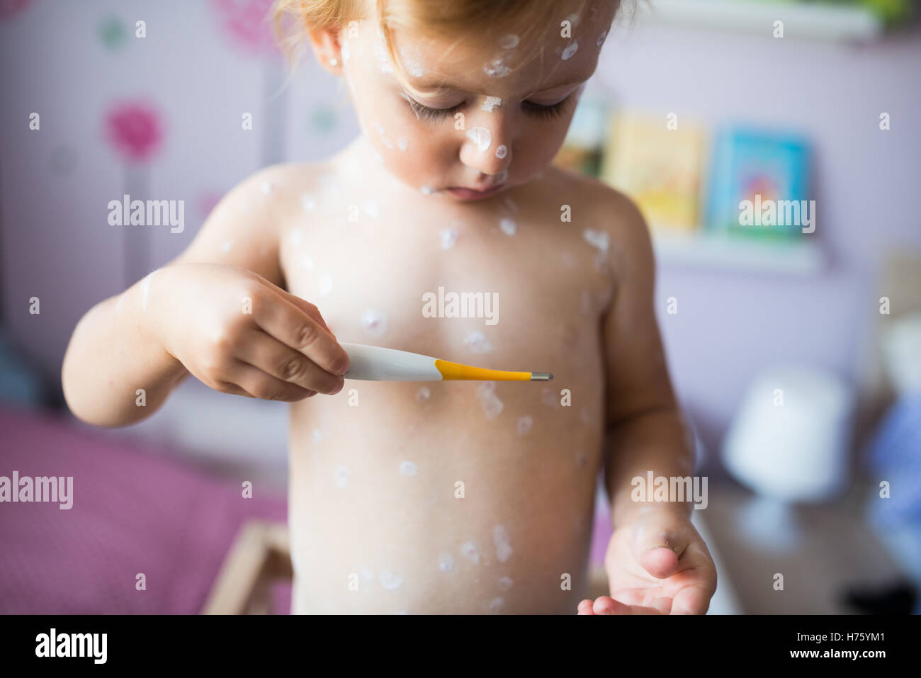 Bellissima bambina con la varicella, tenendo il termometro Foto Stock