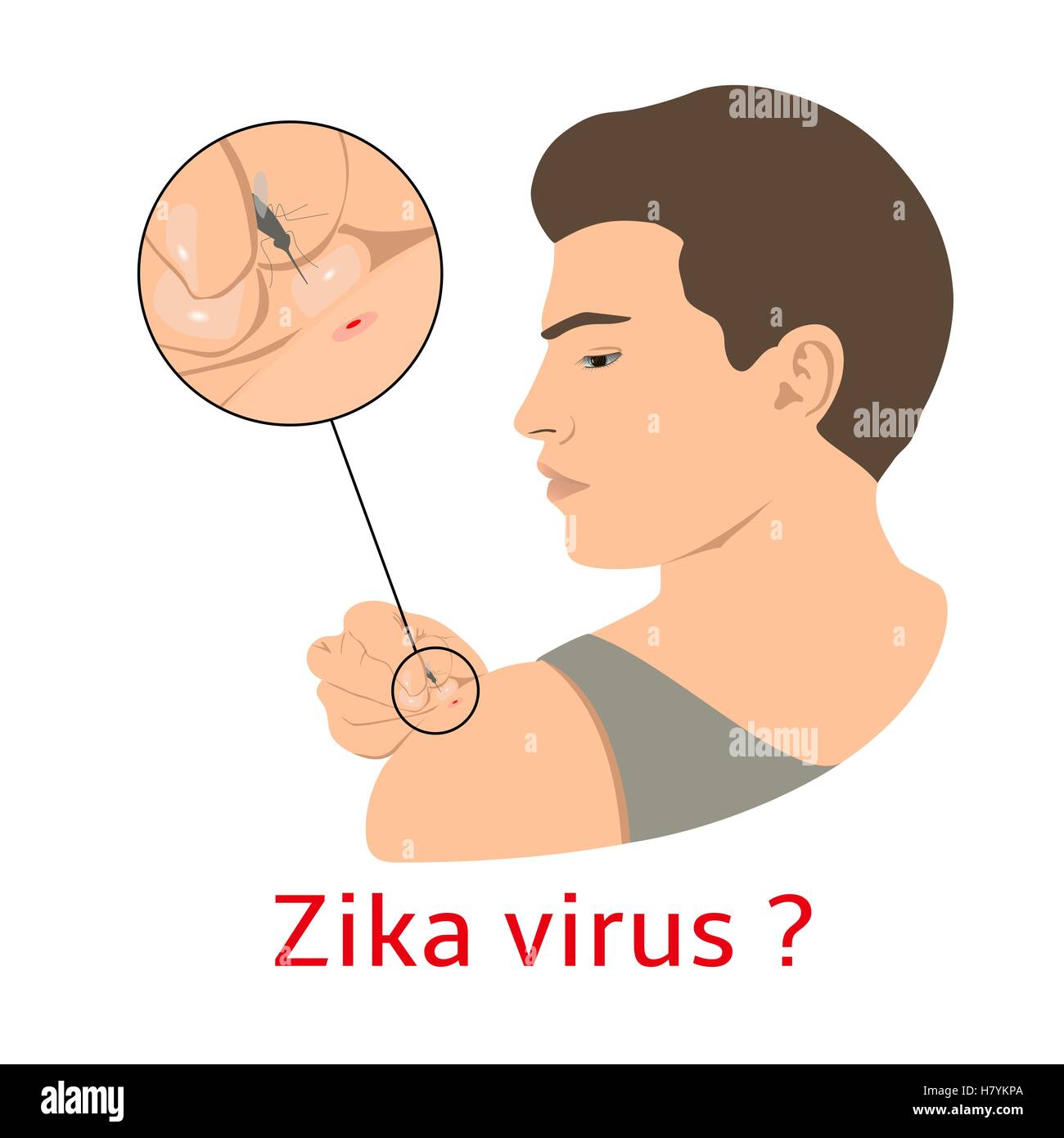 Punture di zanzara l'uomo. Zika virus illustrazione vettoriale. Illustrazione Vettoriale