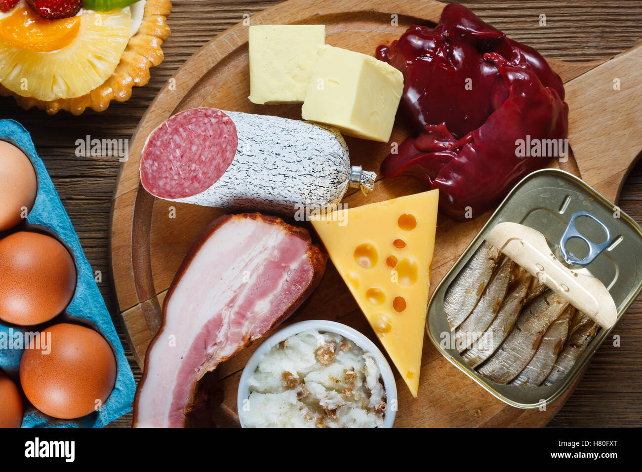 Gli alimenti ricchi di colesterolo come uova, fegato, giallo formaggio, burro, pancetta, lardo con la cipolla, sardine in olio e dessert - a tazza Foto Stock