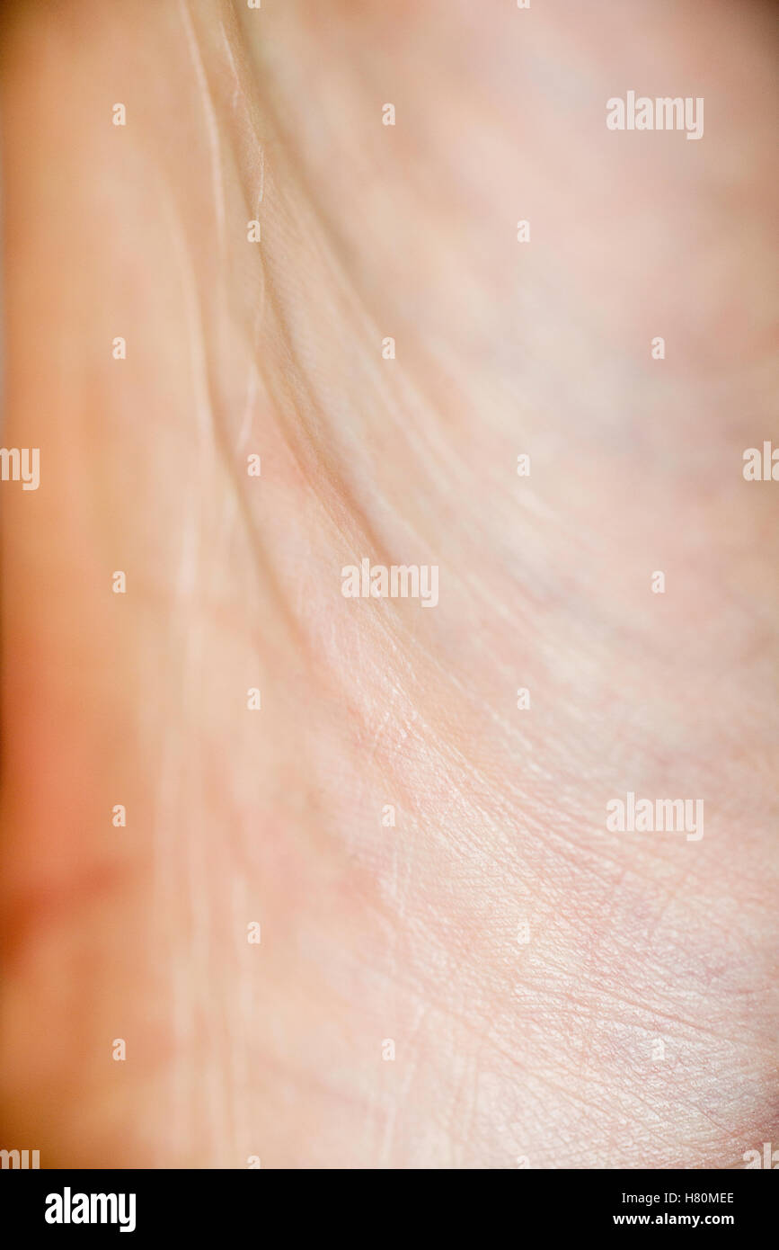 La pelle sulla parte inferiore di un piede maschile Foto Stock