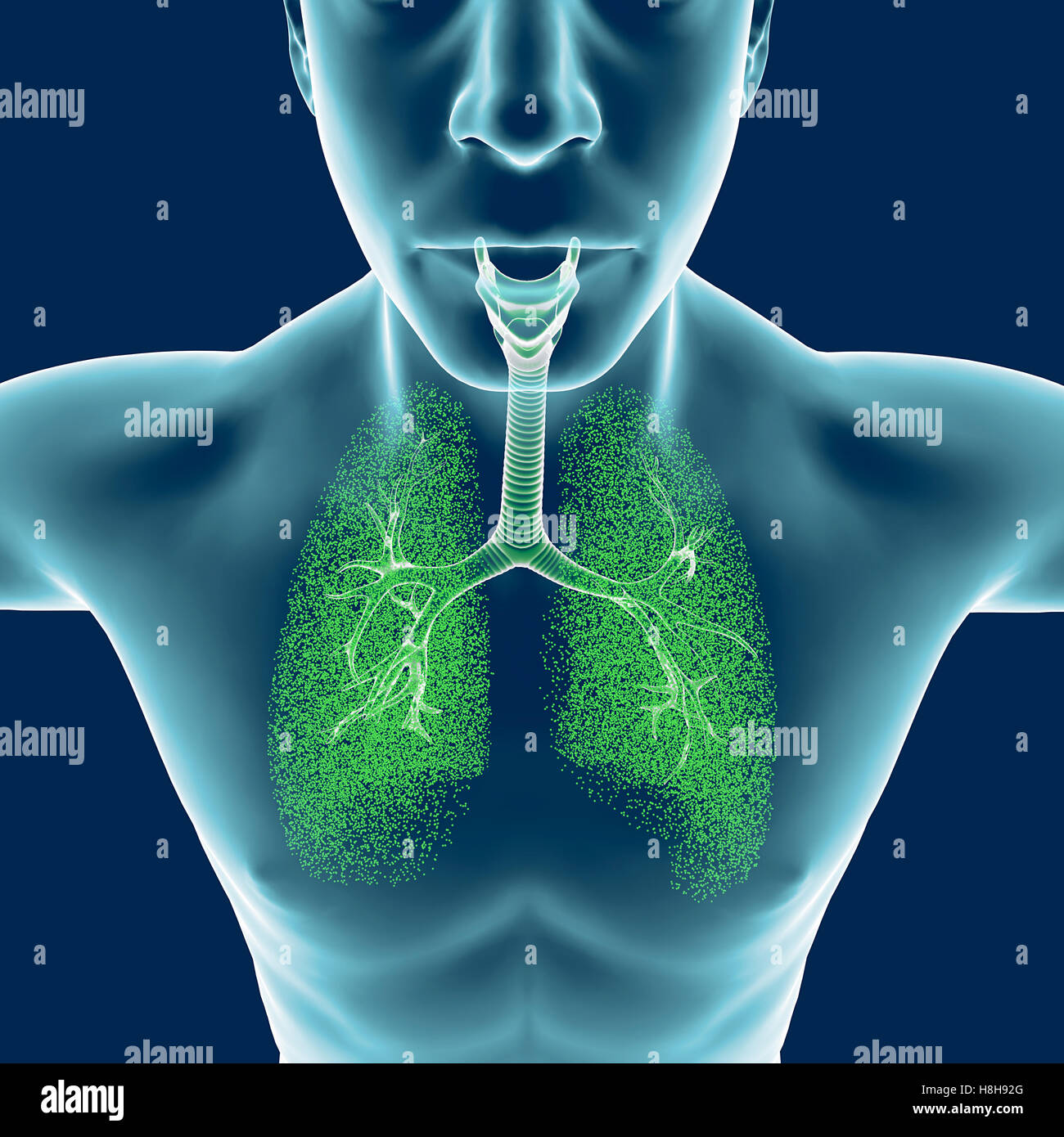 I bronchi, il corpo umano, uomo, polmoni, infiammazione. Il rendering 3D Foto Stock