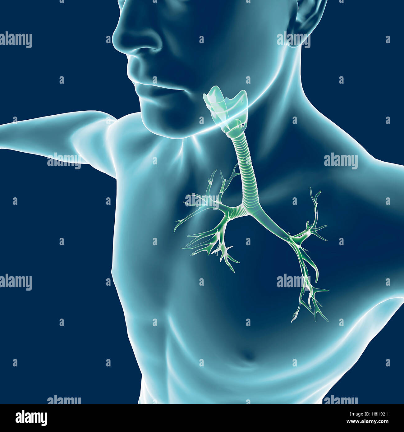 I bronchi, il corpo umano, uomo, polmoni, infiammazione. Il rendering 3D Foto Stock