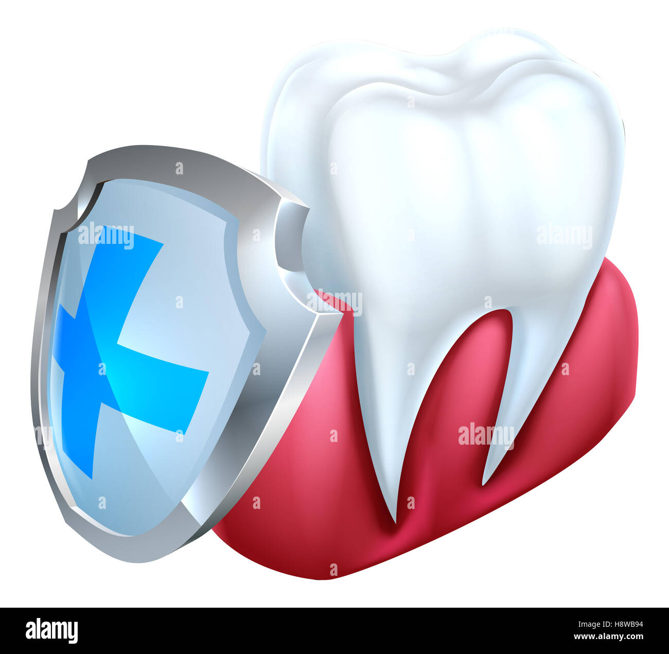 Un medico dental illustrazione di un dente e gomma essendo protetto da una protezione Foto Stock