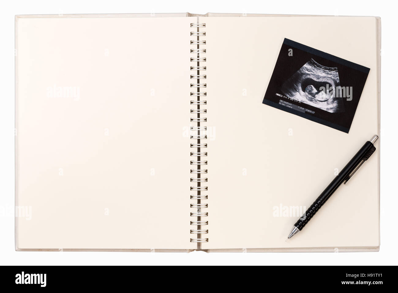 Immagine ad ultrasuoni su Baby diario-blank notebook con penna Foto Stock