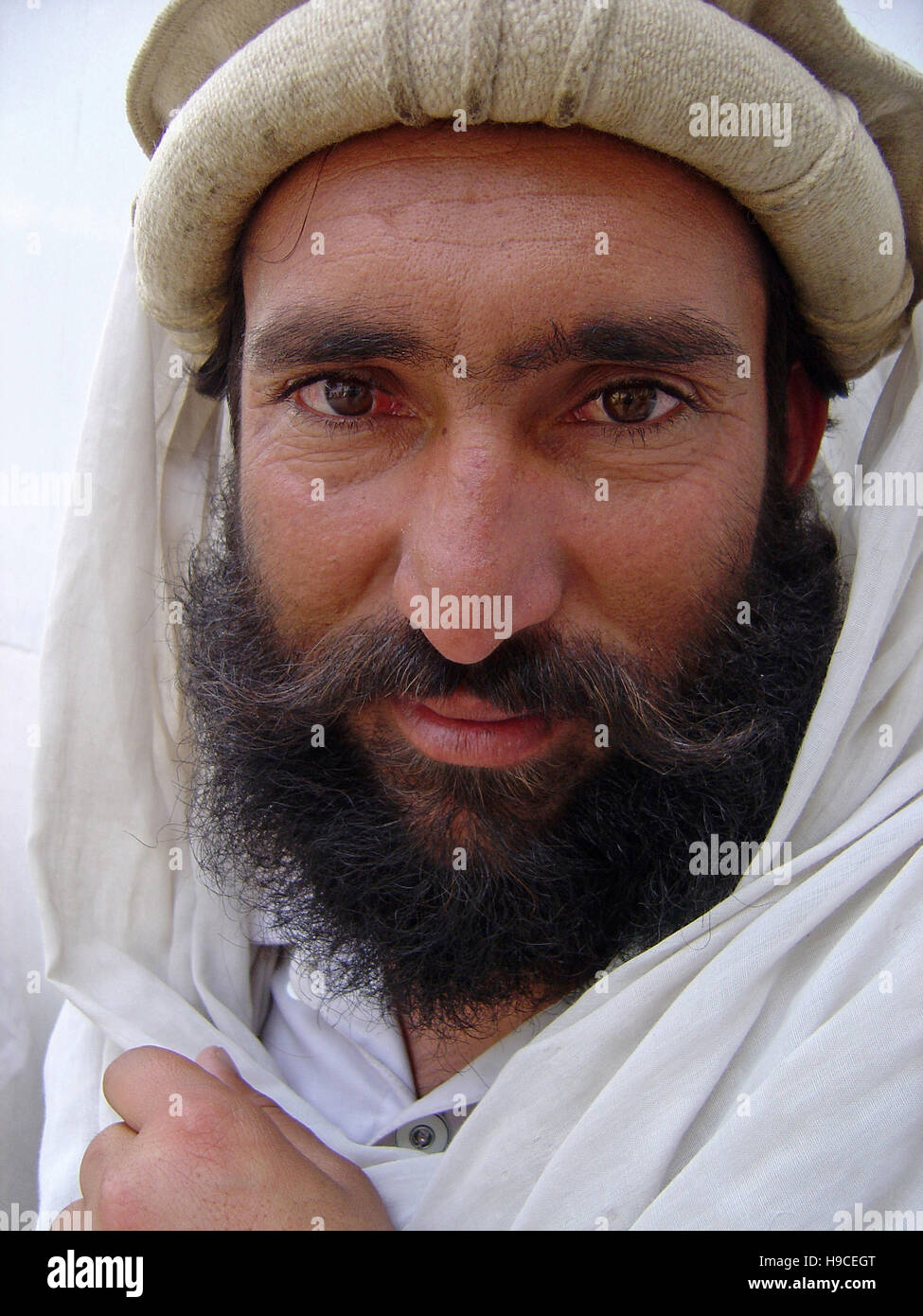 31 Maggio 2004 - Ritratto di un Pashtun uomo dentro il Wazir Akbar Khan centro ortopedico nel nord di Kabul, Afghanistan. Foto Stock