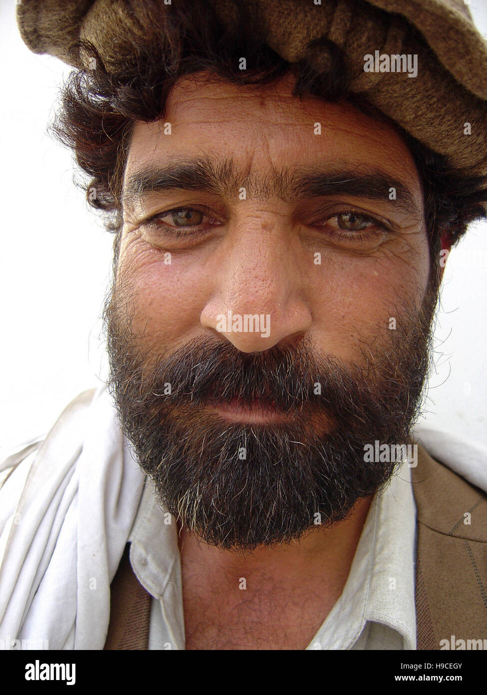 31 Maggio 2004 - Ritratto di un uomo dentro il Wazir Akbar Khan centro ortopedico nel nord di Kabul, Afghanistan. Foto Stock