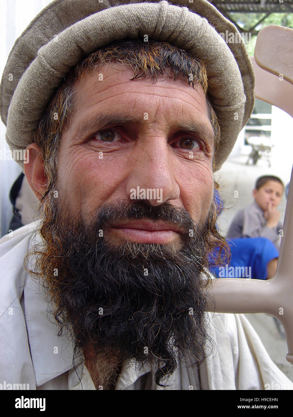 31 Maggio 2004 - Ritratto di un Pashtun tribesman dentro il Wazir Akbar Khan centro ortopedico nel nord di Kabul, Afghanistan. Foto Stock