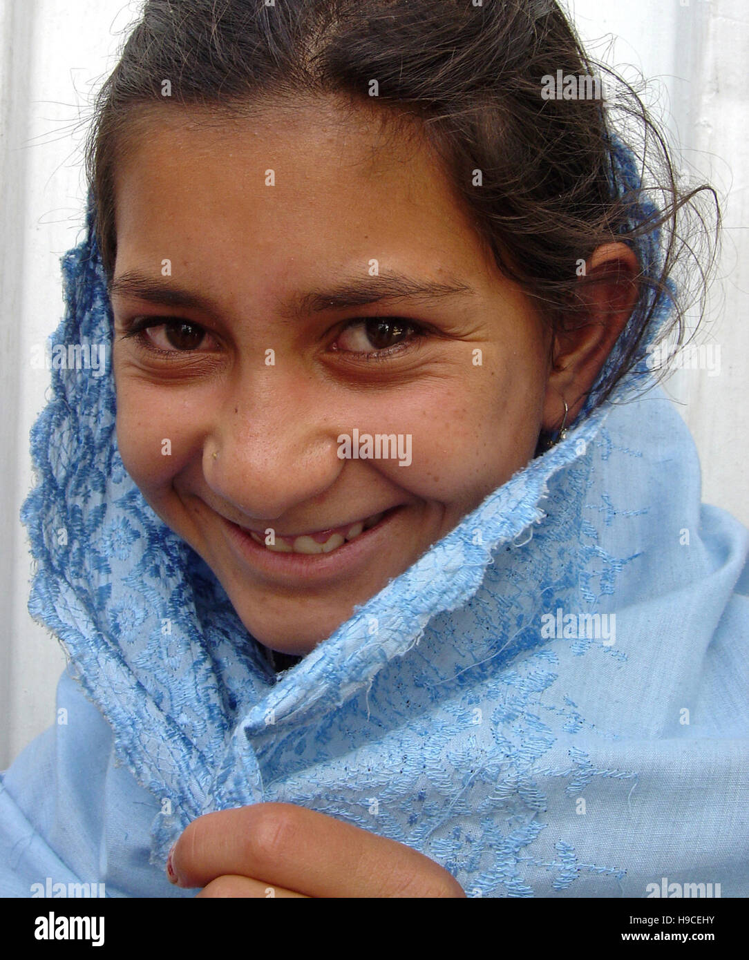 Il 31 maggio 2004 il ritratto di una giovane ragazza all'interno il Wazir Akbar Khan centro ortopedico nel nord di Kabul, Afghanistan. Foto Stock