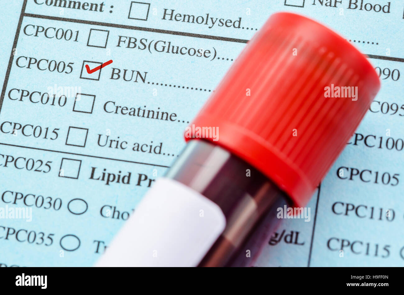 Rosso su mard Bunl test per funzione. Foto Stock