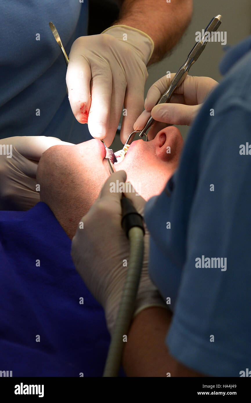 Minden, Germania. Xxi Nov, 2016. Un dentista e un infermiere dentali trattare un paziente di Minden, Germania, 21 novembre 2016. Foto: Maurizio Gambarini/dpa/Alamy Live News Foto Stock