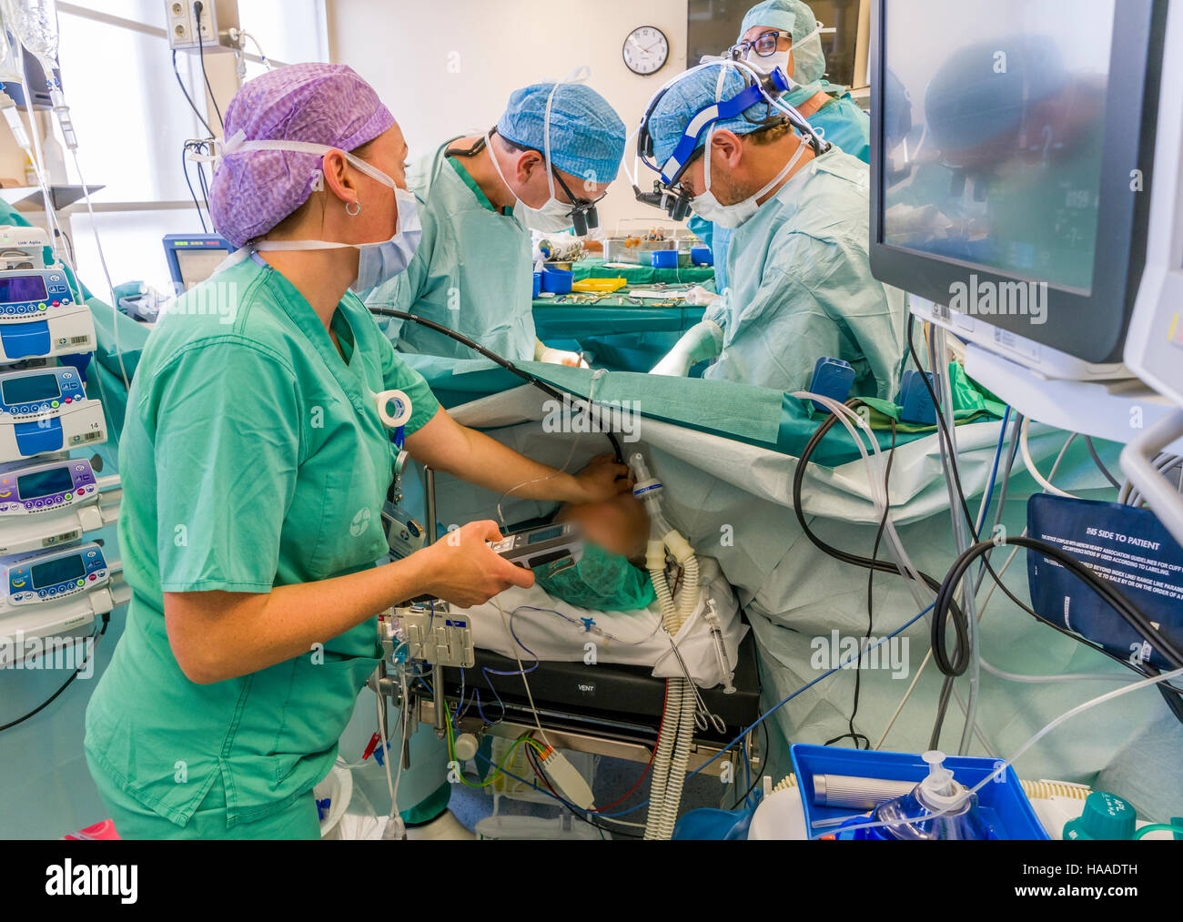 Sostituzione di valvola cardiaca chirurgia, sala operatoria, Reykjavik, Islanda Foto Stock