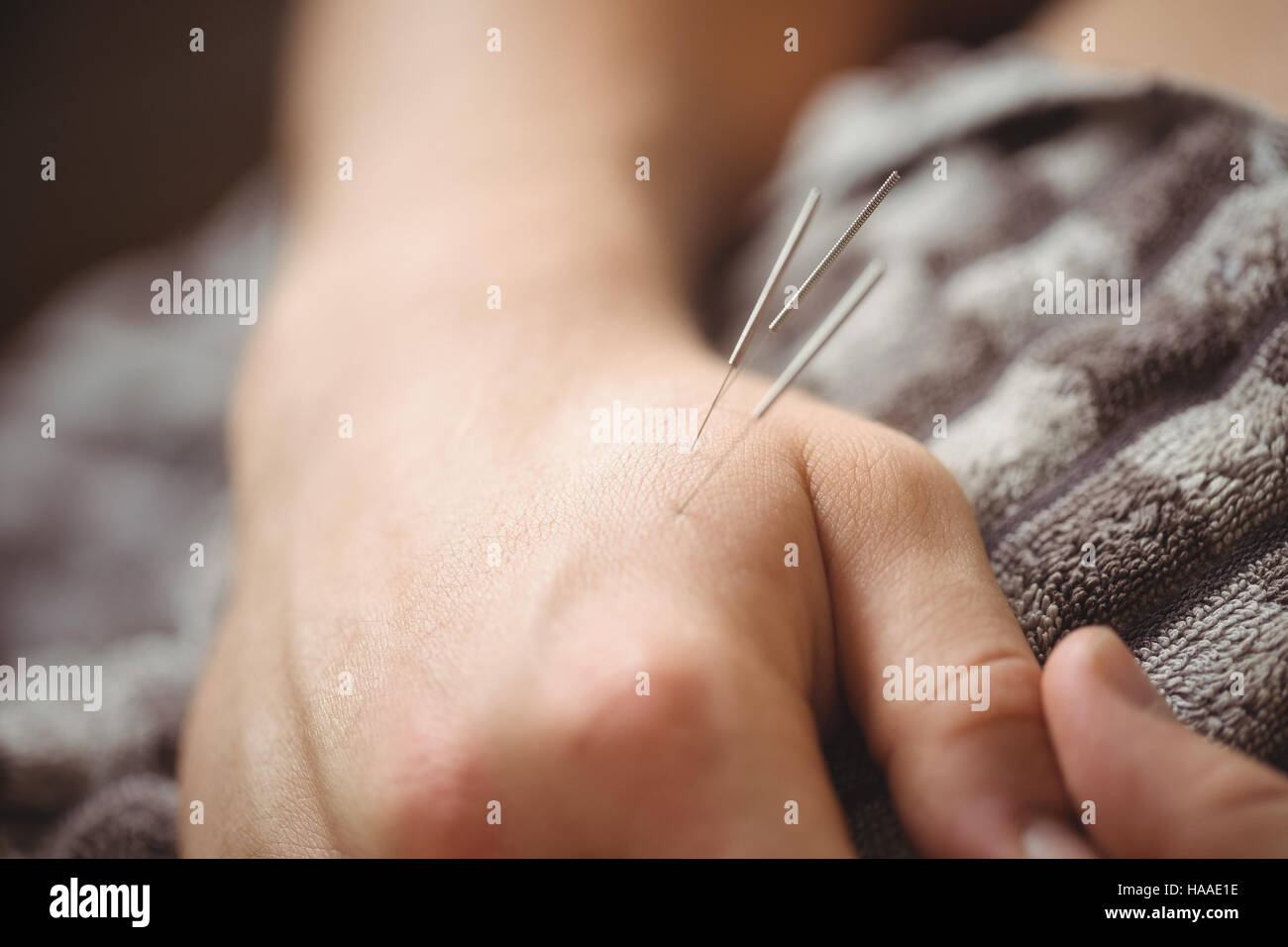 Paziente ottenere agugliatura secco a portata di mano Foto Stock