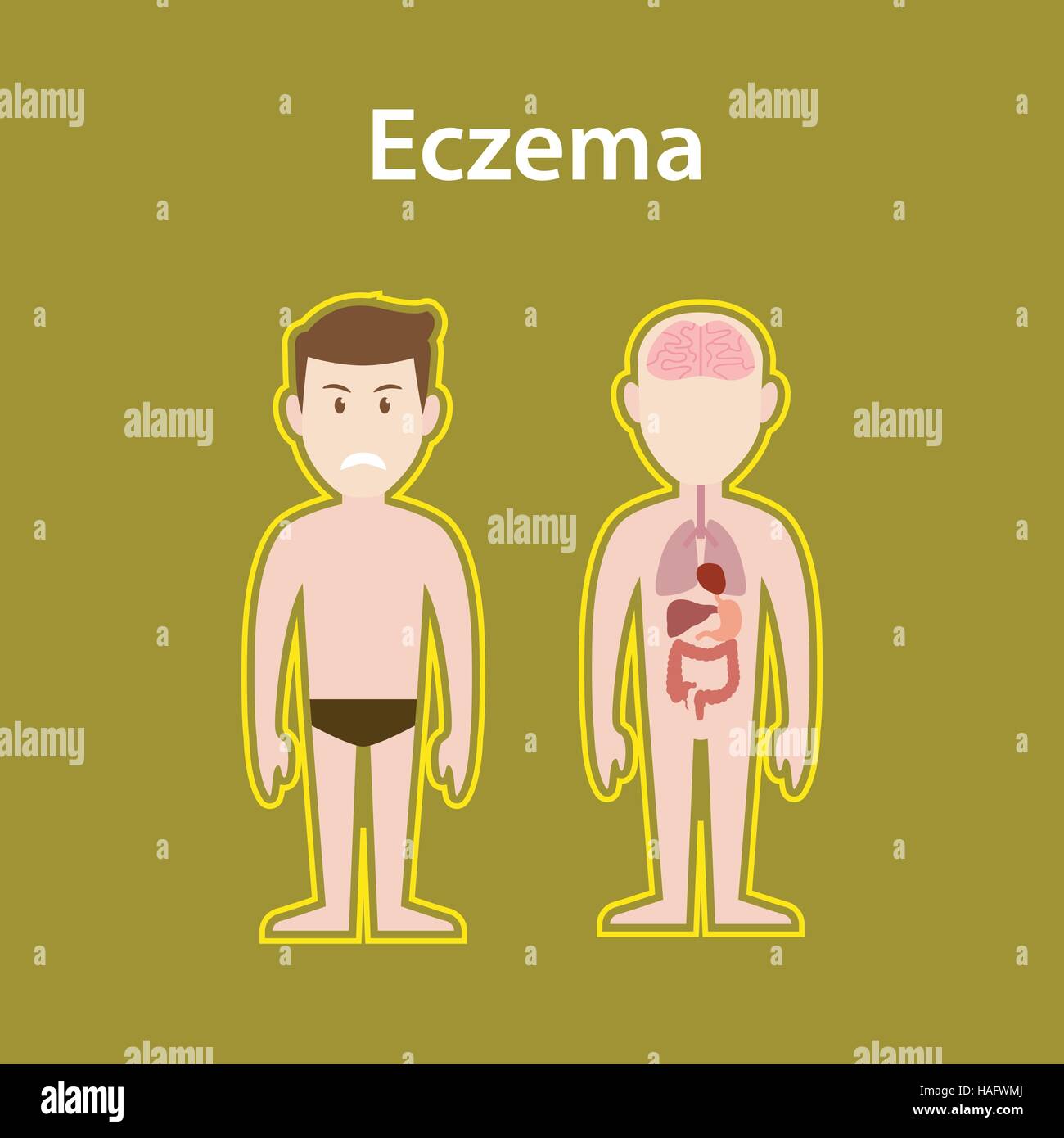 Eczema malati illustrazione con il corpo umano completa di supporto e protezione di organo segno manifesto di testo Illustrazione Vettoriale