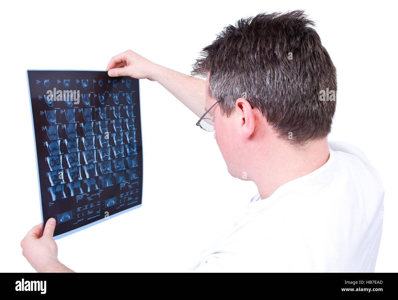 Medico analizing un immagini a risonanza magnetica Foto Stock