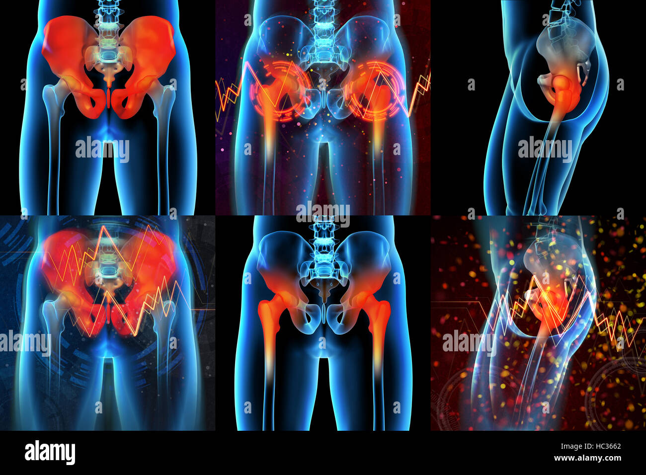 3D rendering medical illustrazione di un doloroso sacrum Foto Stock