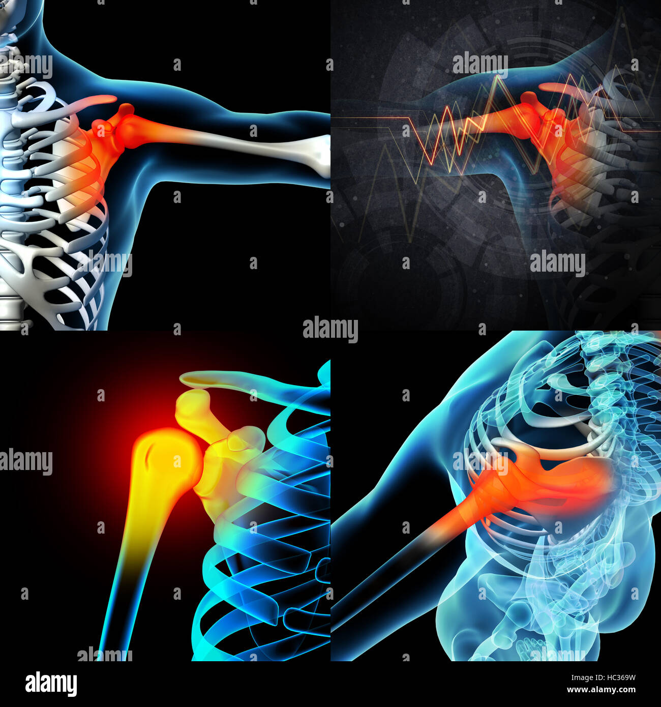 3D rendering spalla umana dolore con la parte anatomica di uno scheletro di spallamento Foto Stock