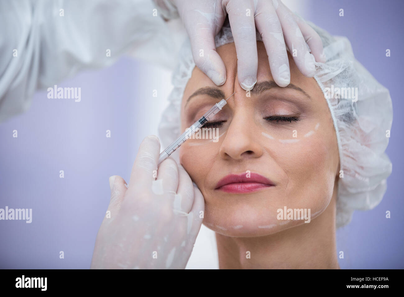 Donna con marcato faccia ricevente iniezione di Botox Foto Stock